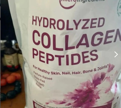 Testimonio: Grandes diferencias en mi piel